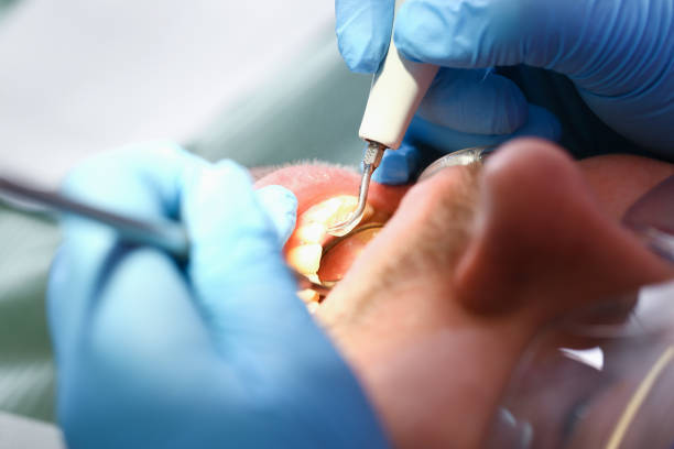 Best Cosmetic Emergency Dentistry in Lockport, LA